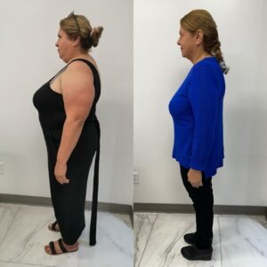 obesity-out-dr-luis-canocirugía-bariátrica-y-metabólica-de-alta-calidad-en-Tijuana-testimonio-1 (1)