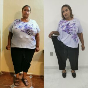 obesity-out-dr-luis-canocirugía-bariátrica-y-metabólica-de-alta-calidad-en-Tijuana-testimonio-1 (5)